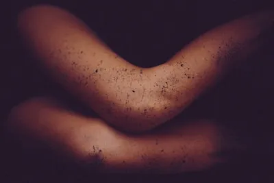 Uncovering the Meaning of Burned Skin Dreams: Emotional Healing & Resilience